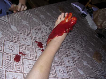 Une angelure pas soign�e